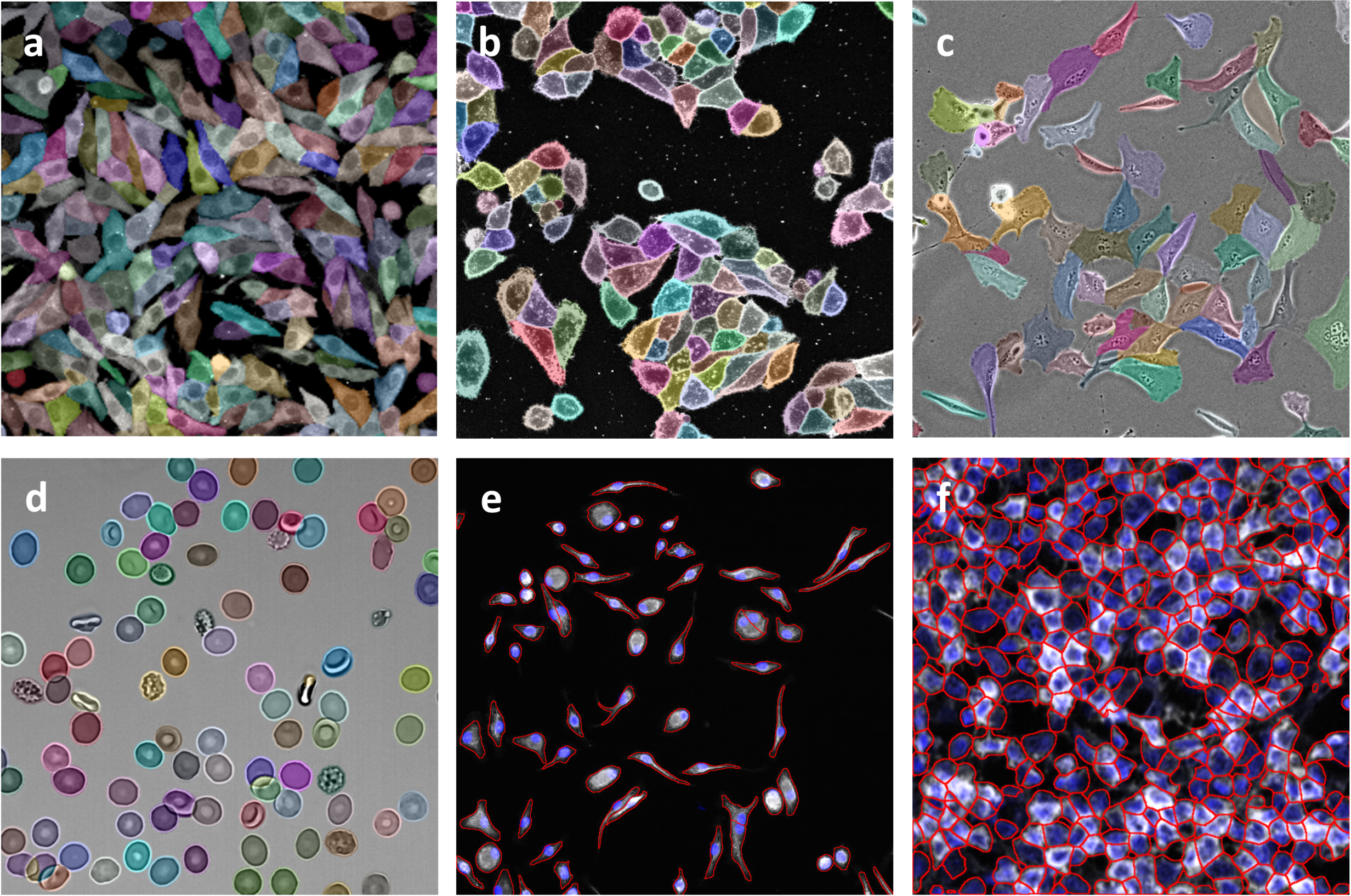 understanding-cell-segmentation-a-key-tool-in-spatial-imaging